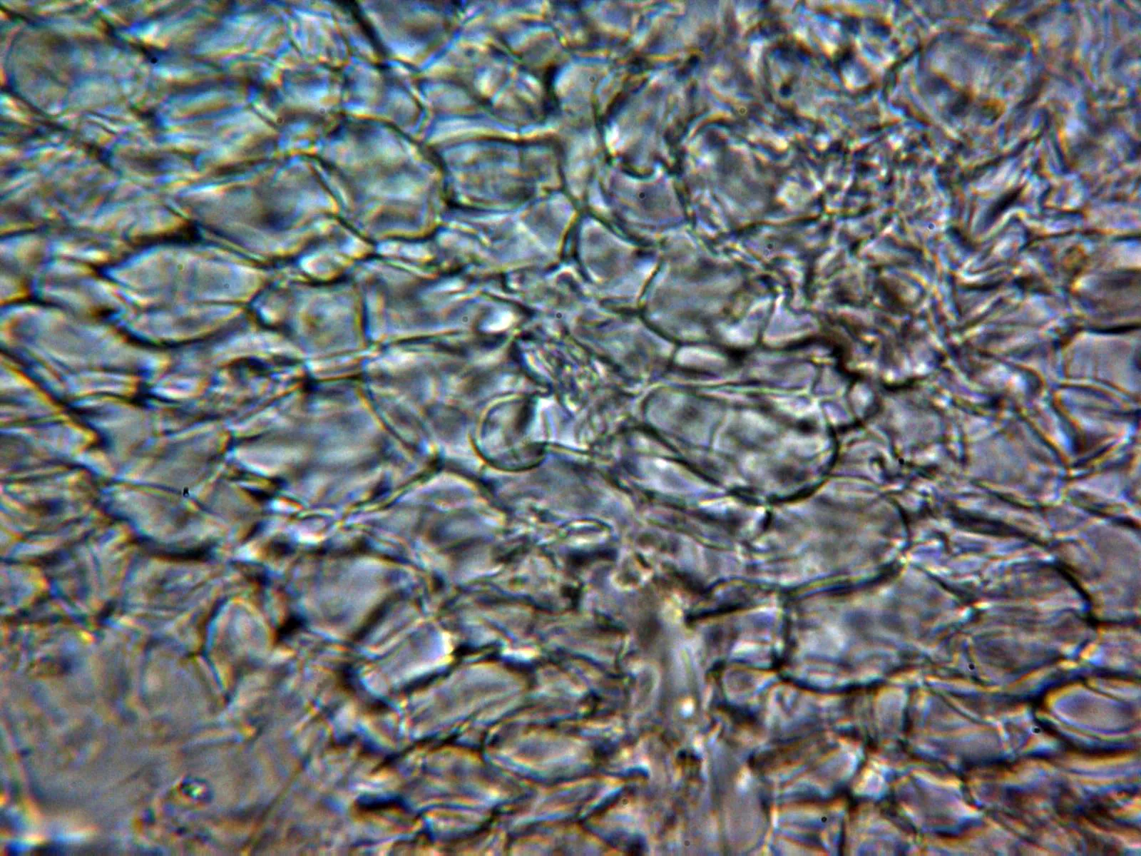 Microscopía de Orbilia xanthostigma - 10 - Excípulo 2